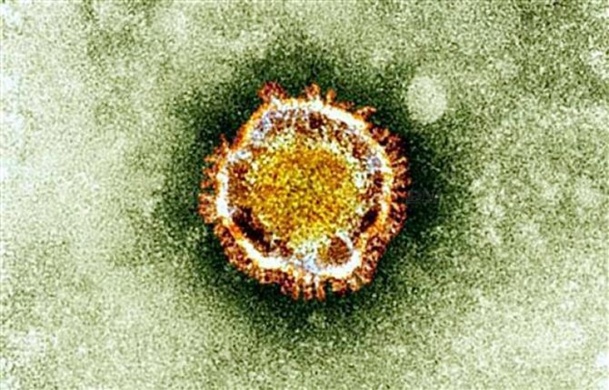 Jusqu'à présent, le nouveau coronavirus a provoqué le décès de 20 personnes à travers le monde - Photo AFP / British Health Protection