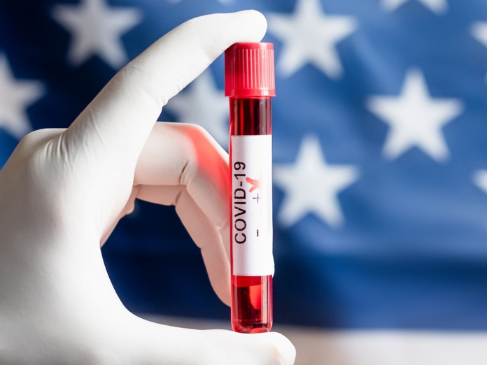 Pour le voyage USA, il sera nécessaire de présenter un test négatif de -24h - Depositphotos