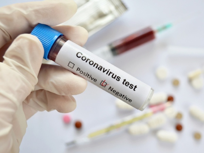 Pour voyager à Chypre, le résultat négatif d'un test PCR est obligatoire - Depositphotos @julitt Pour voyager à Chypre, le résultat négatif d'un test PCR est obligatoire - Depositphotos @julitt