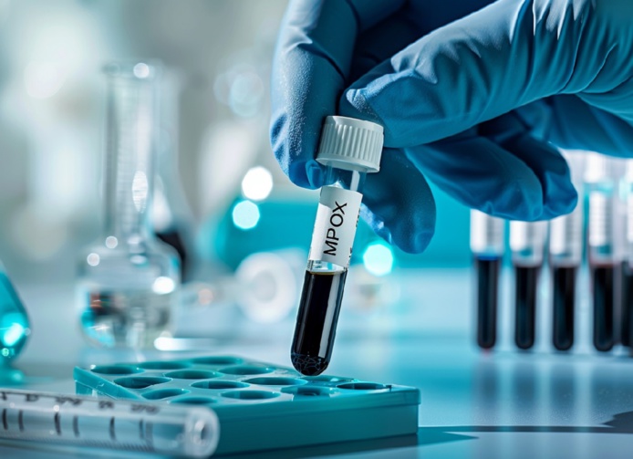 Mpox Maroc : premier cas en Afrique du Nord - Photo : ©Pepita Mpox Maroc : premier cas en Afrique du Nord - Photo : ©Pepita