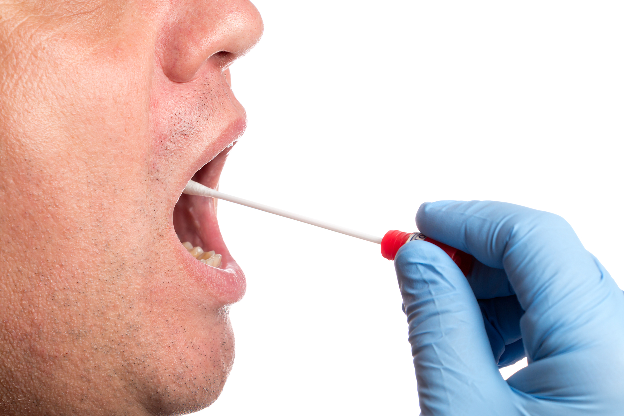 Les tests salivaires rapides, un outil majeur pour mieux contrôler
