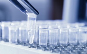 Naufrage tests PCR : les laboratoires ont-ils refusé de partager le pactole ?