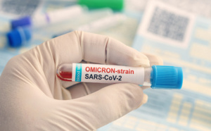 Omicron près… il coupe l’élan avant qu’il ne se rétracte ! 🔑 Omicron près… il coupe l’élan avant qu’il ne se rétracte ! 🔑